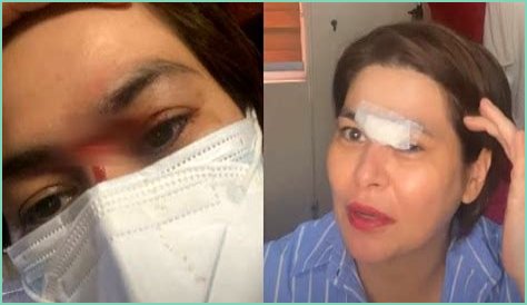 Filipina actress needed stitches after eating spicy ramen